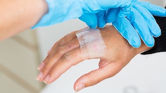 How Flexible Materials Innovation Advances Wound Care and Closure